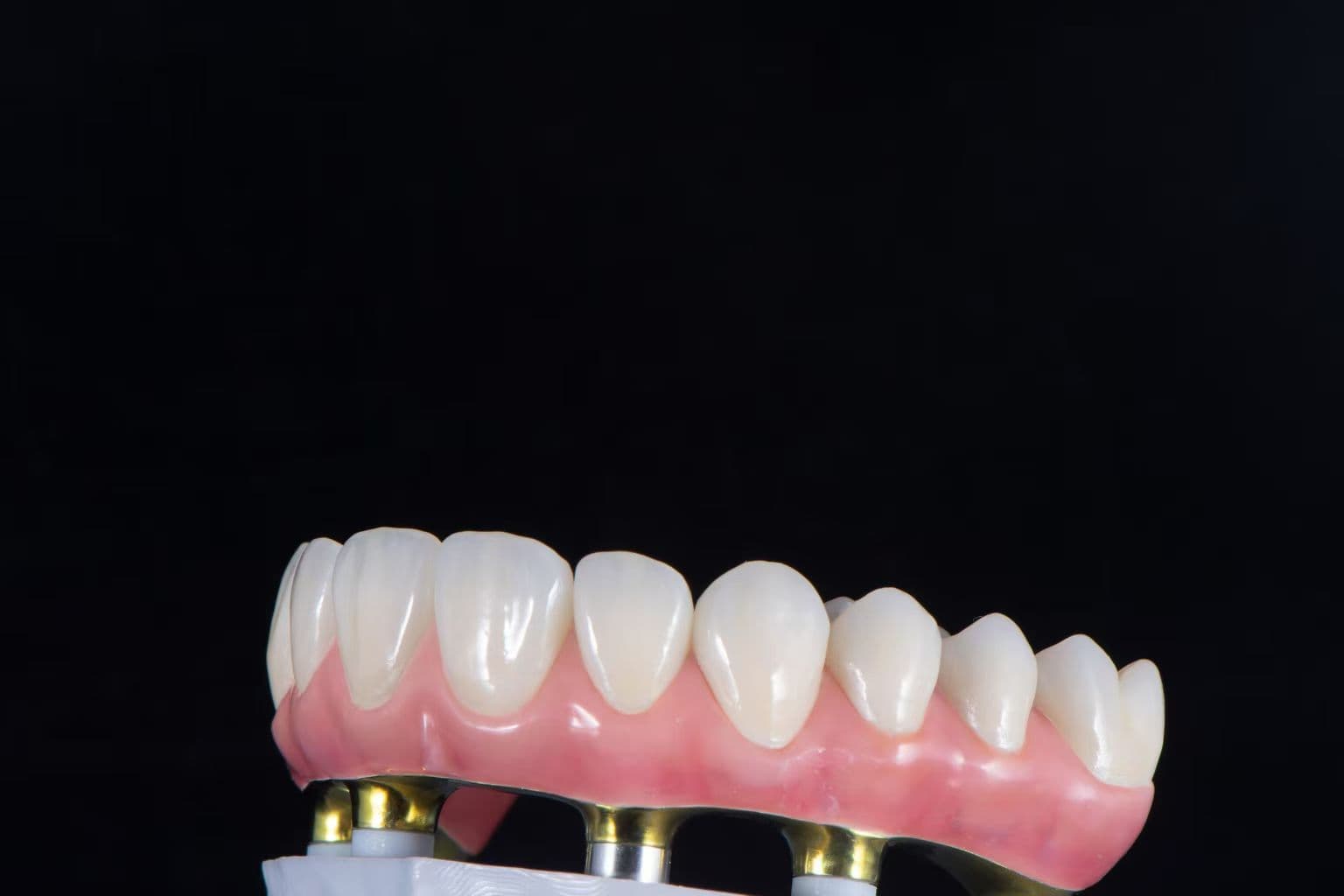 Implant bridge