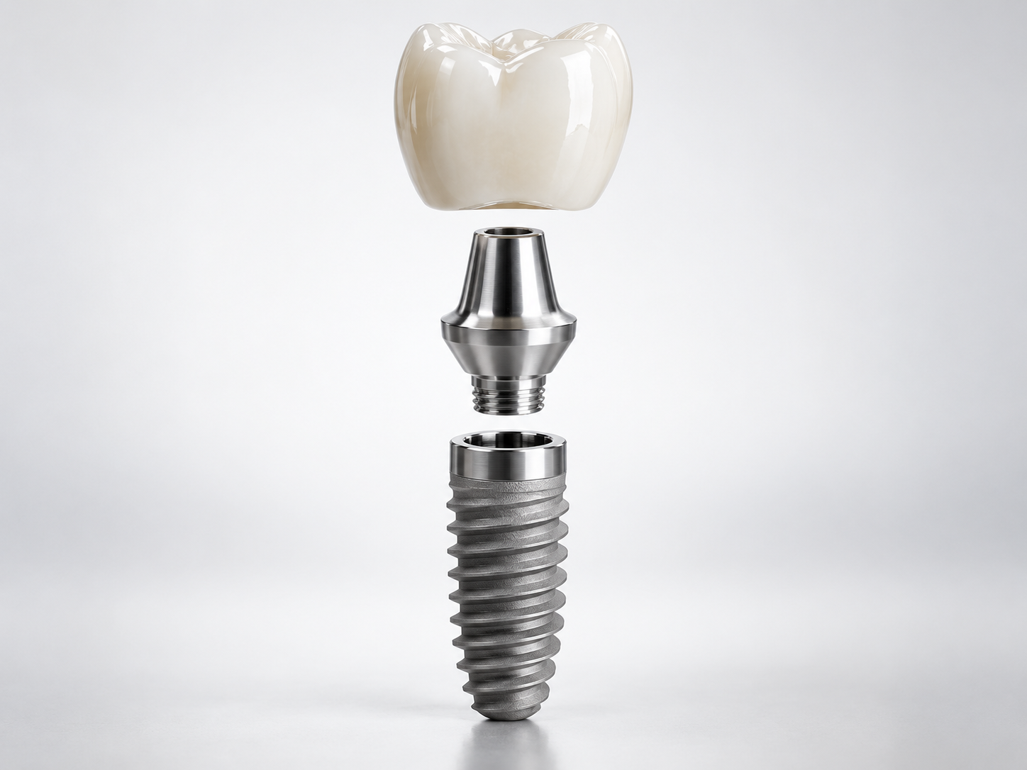 Exploded view of a dental crown, abutment, and implant