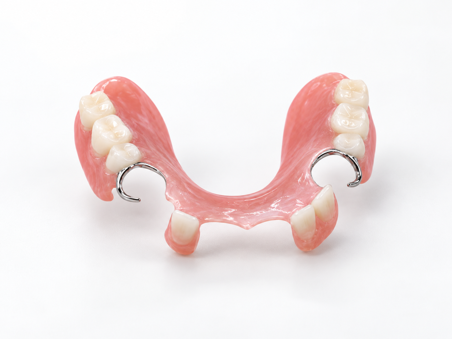 Pink removable partial denture with replacement teeth and metal clasps